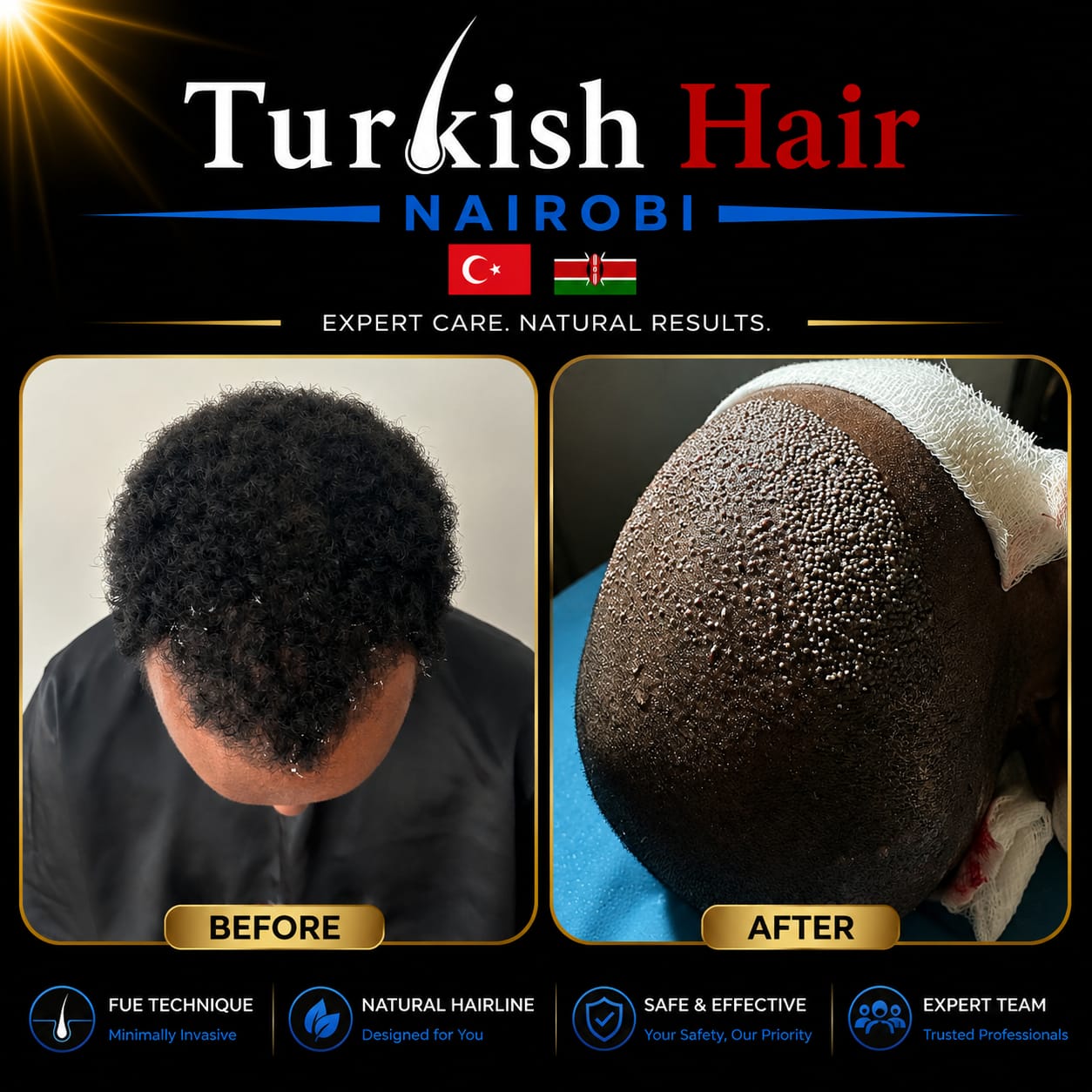 Turkish Hair Nairobi Case 12